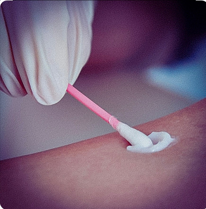 Patch Test